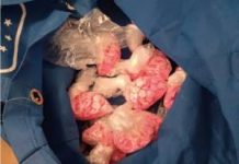 Suspected drugs trafficker arrested